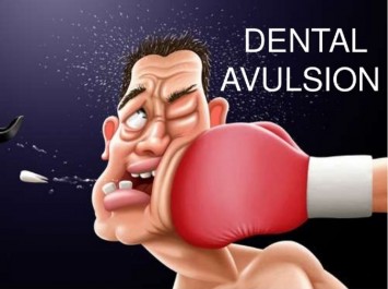 dental avulsion dental avulsion
