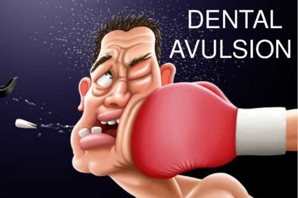 dental avulsion